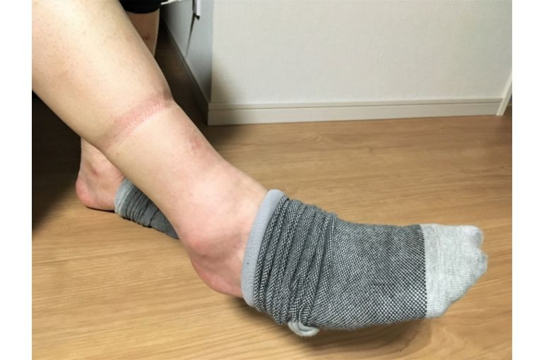 血流と老廃物 〜なぜむくむのか？〜